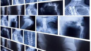 peninsula urgent care - injury & Imaging Services
